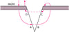 Sutura a materassaio verticale