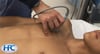 Probe Placement Perpendicular to Ribs