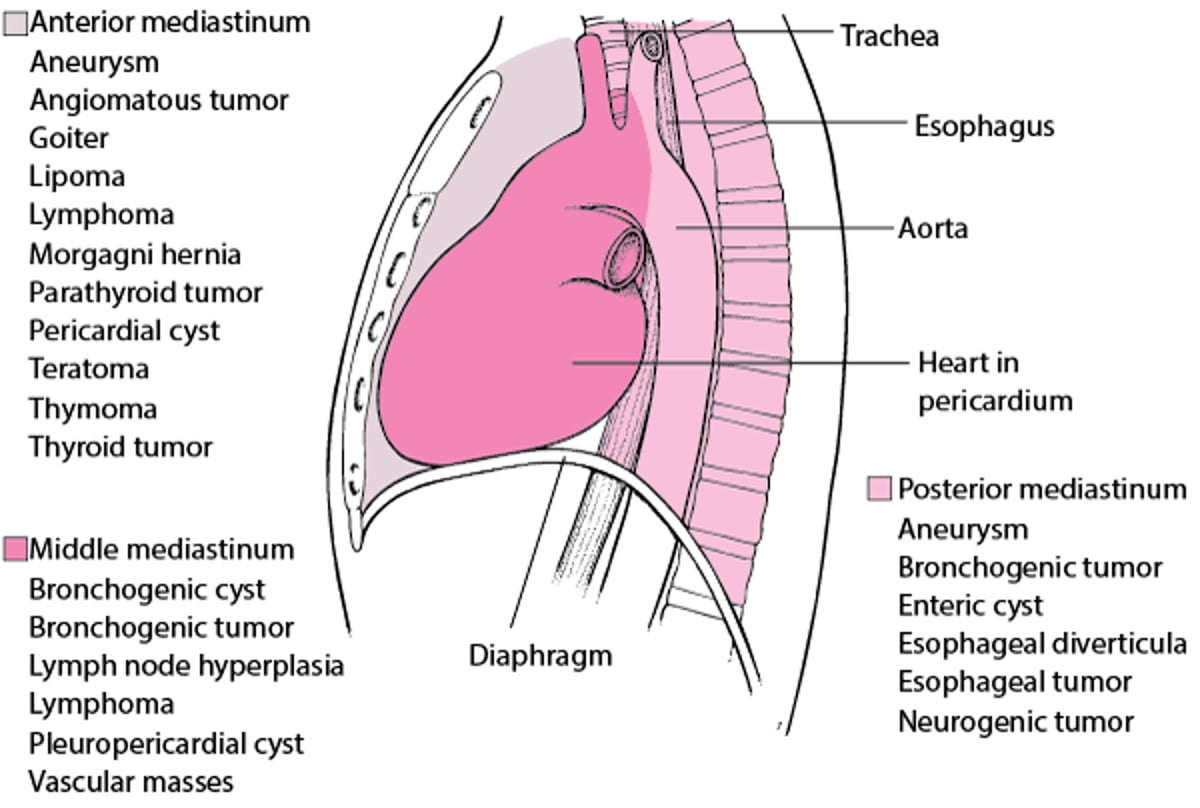 Some Causes of Mediastinal Masses in Adults