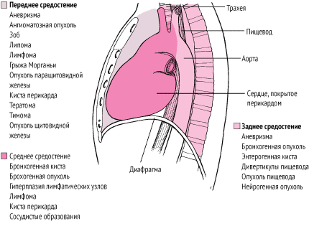 Некоторые причины объемных образований средостения у взрослых