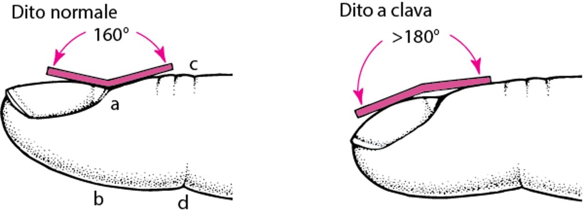 Misurazione dell'ippocratismo digitale