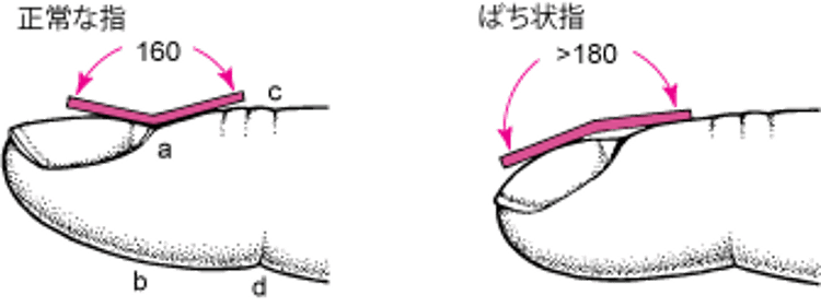 ばち指の測定