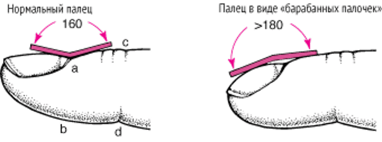 Измерение "барабанных палочек"