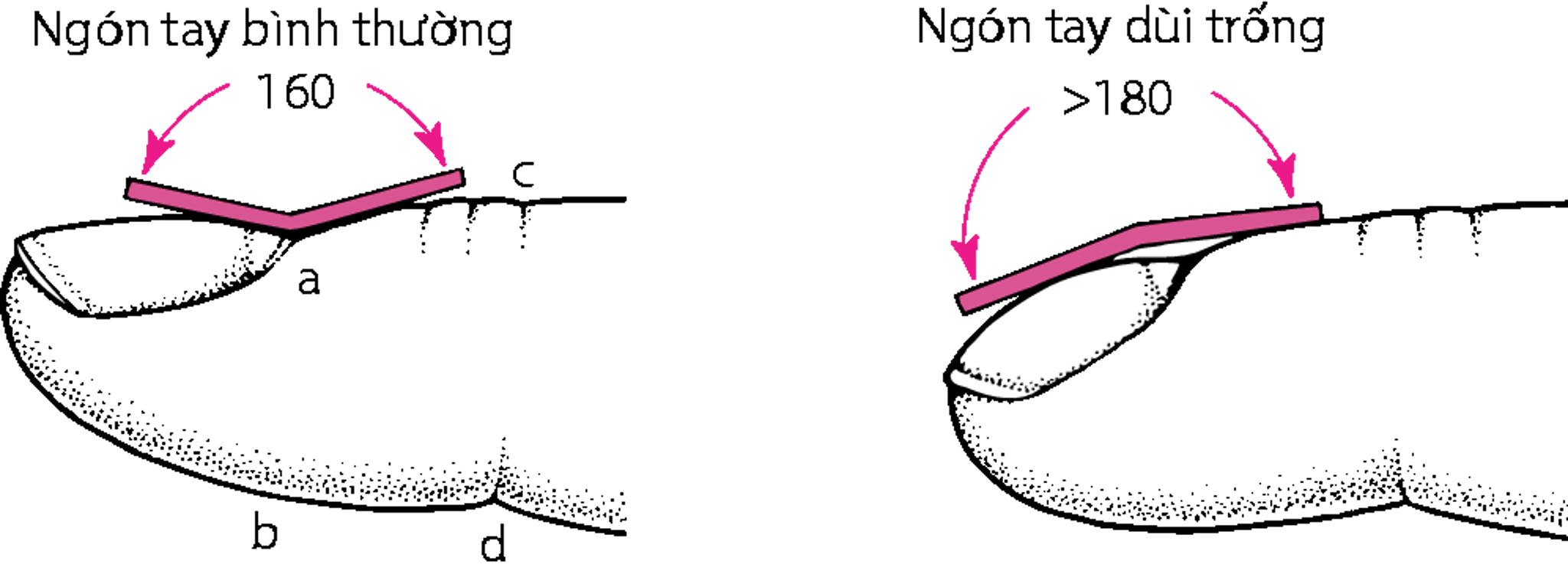 Đo ngón tay dùi trống