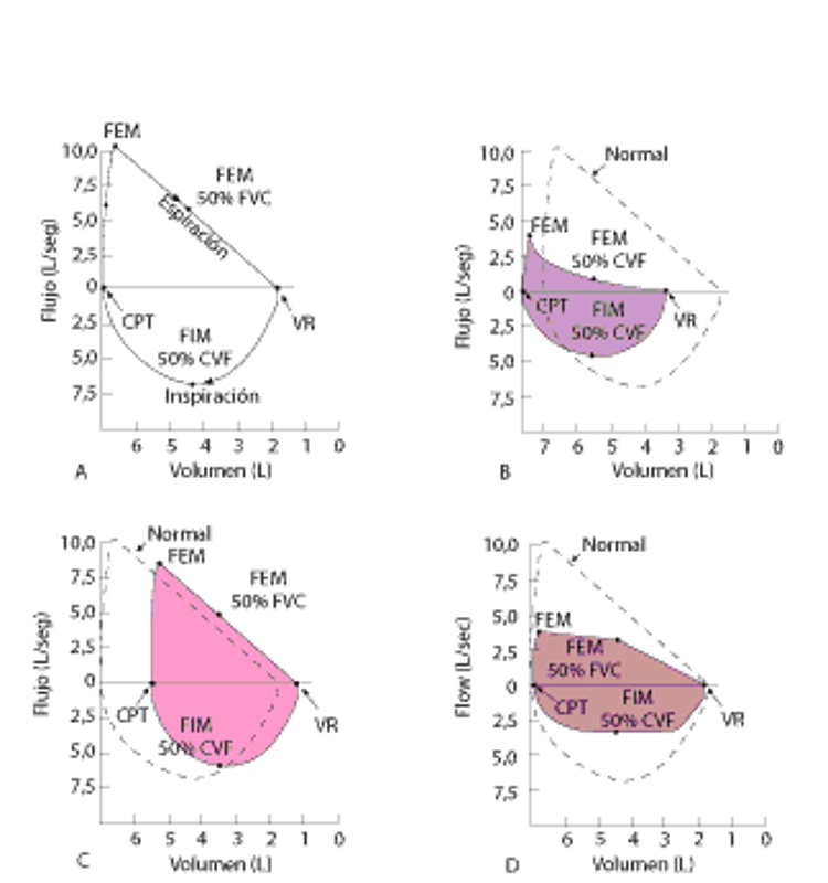 Curvas de flujo-volumen