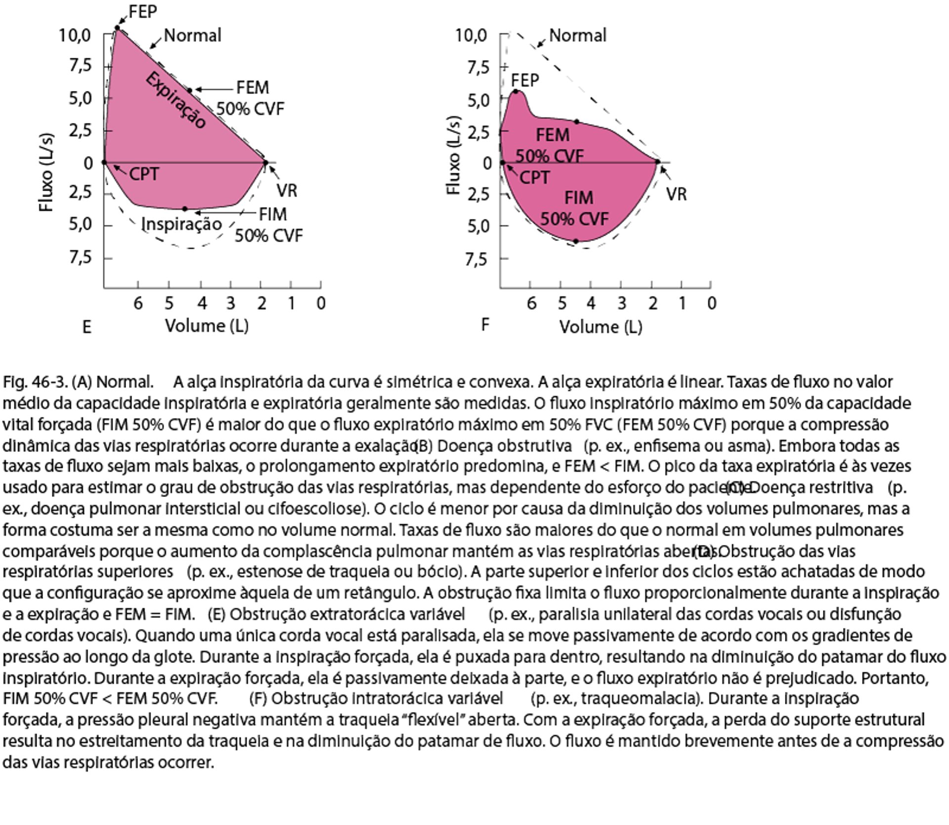 Fluxo de ar, volumes pulmonares e curvas fluxo-volume - Fluxo de ar ...