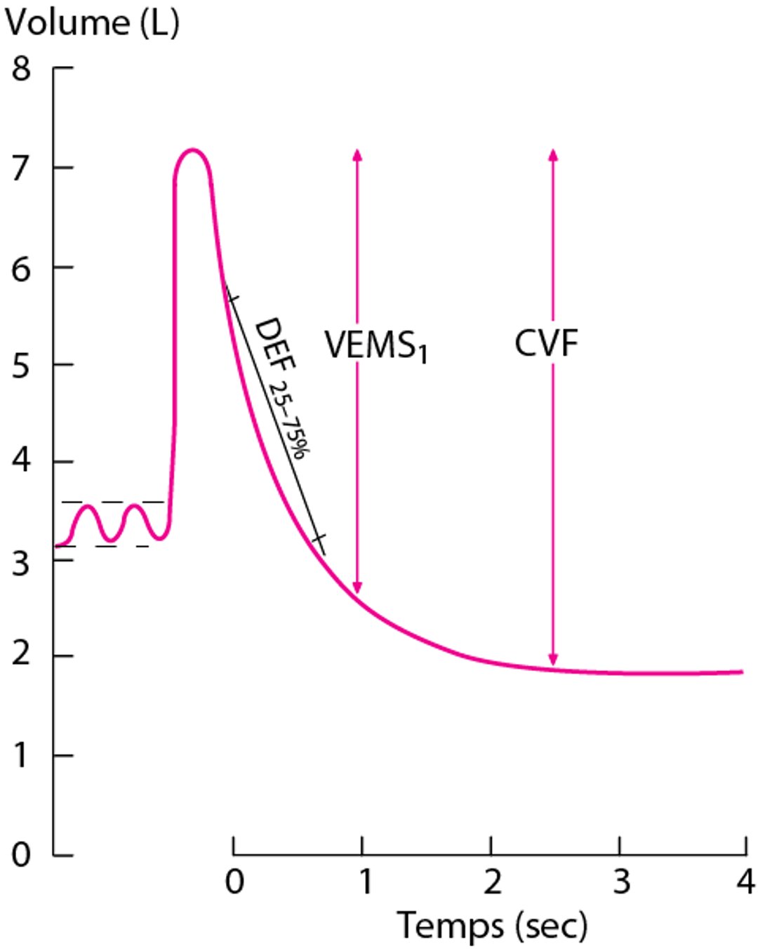 Spirogramme normal