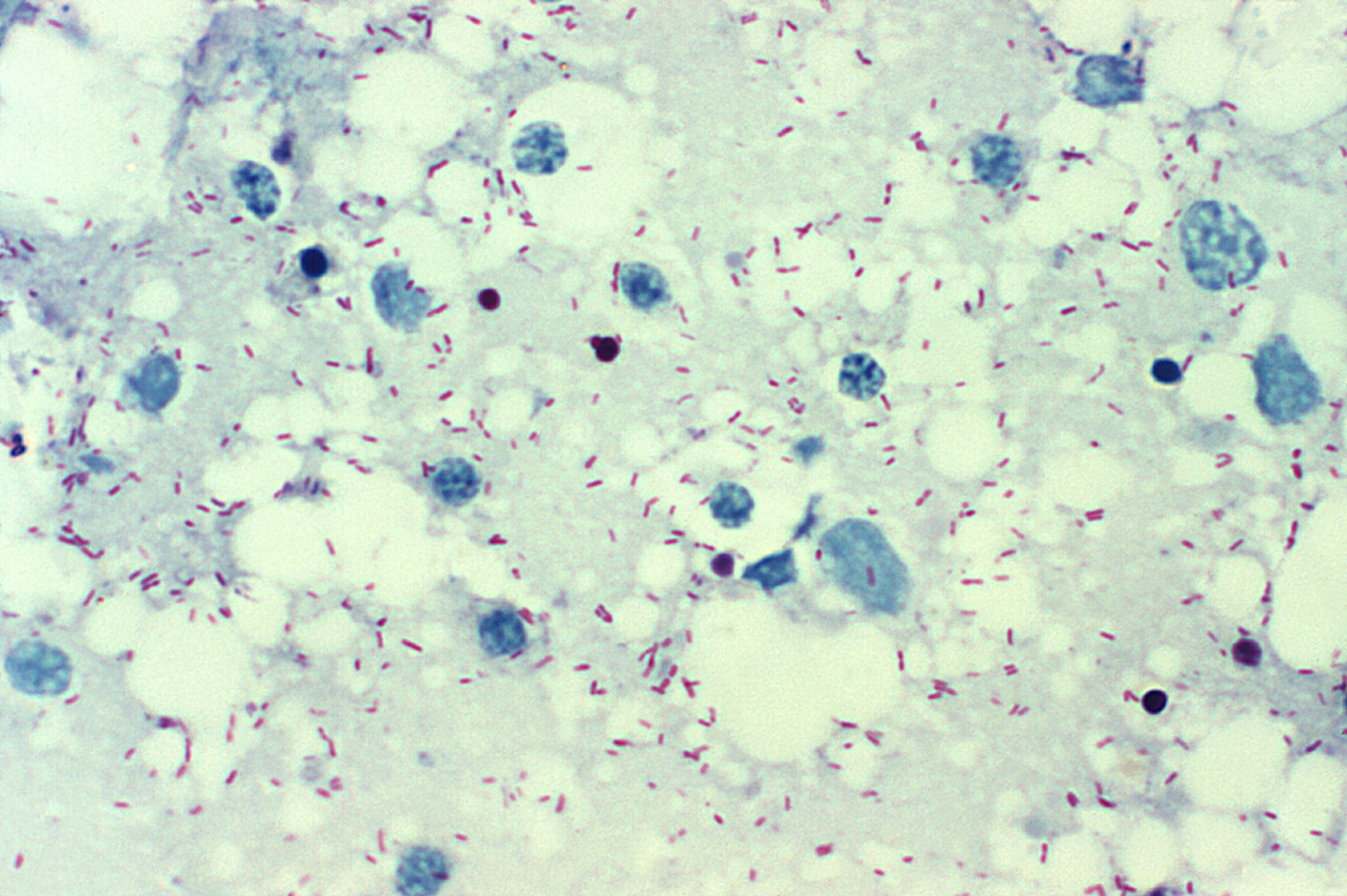 <i >Rickettsia rickettsii</i> (Smear)
