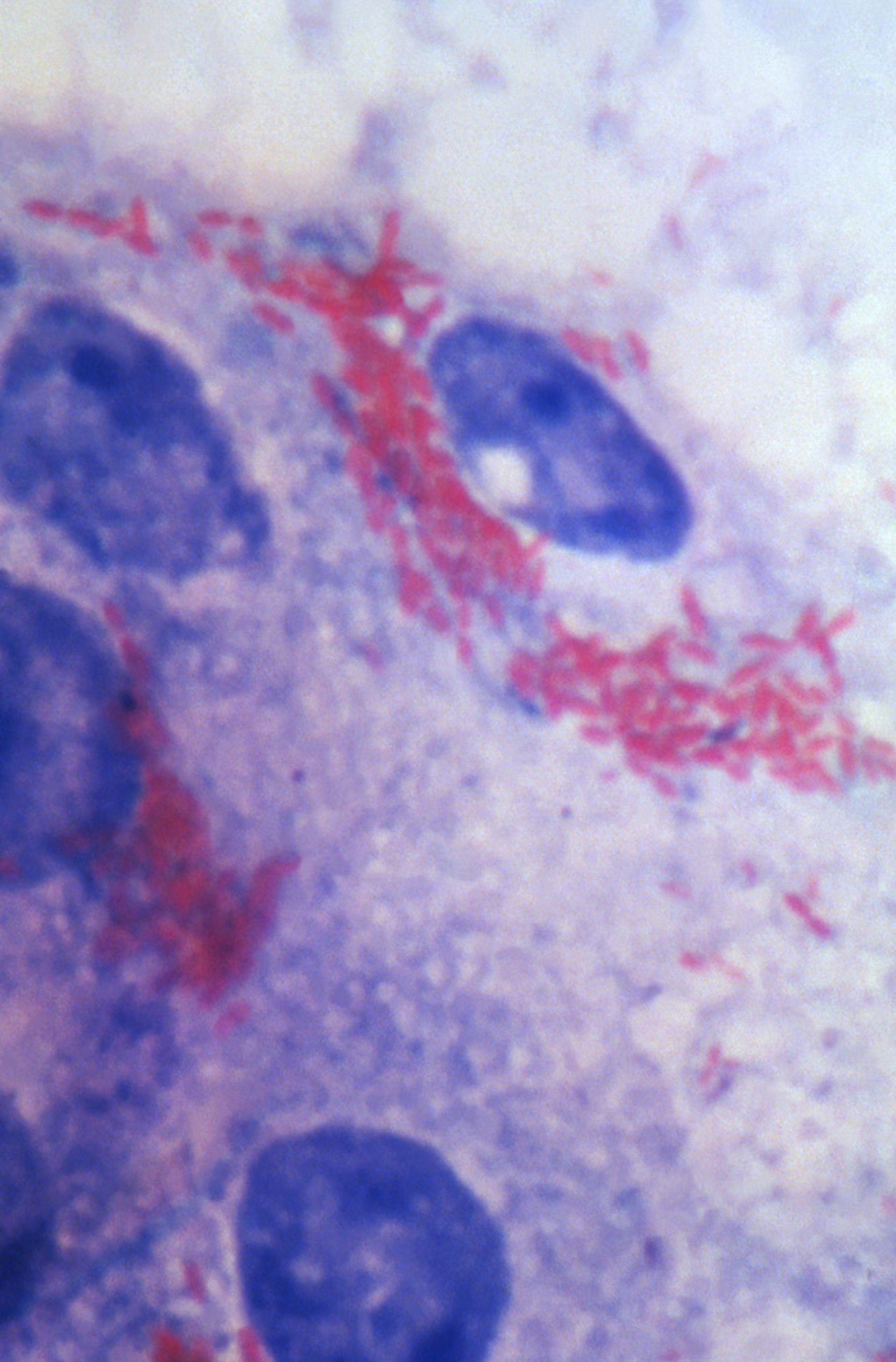 <i >Rickettsia prowazekii（普氏立克次体）</i>（涂片）