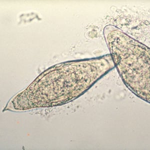 Schistosoma intercalatum Eggs