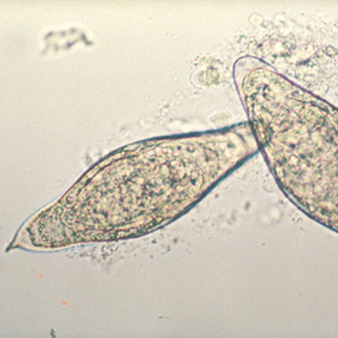 Huevos de <i >Schistosoma intercalatum</i>