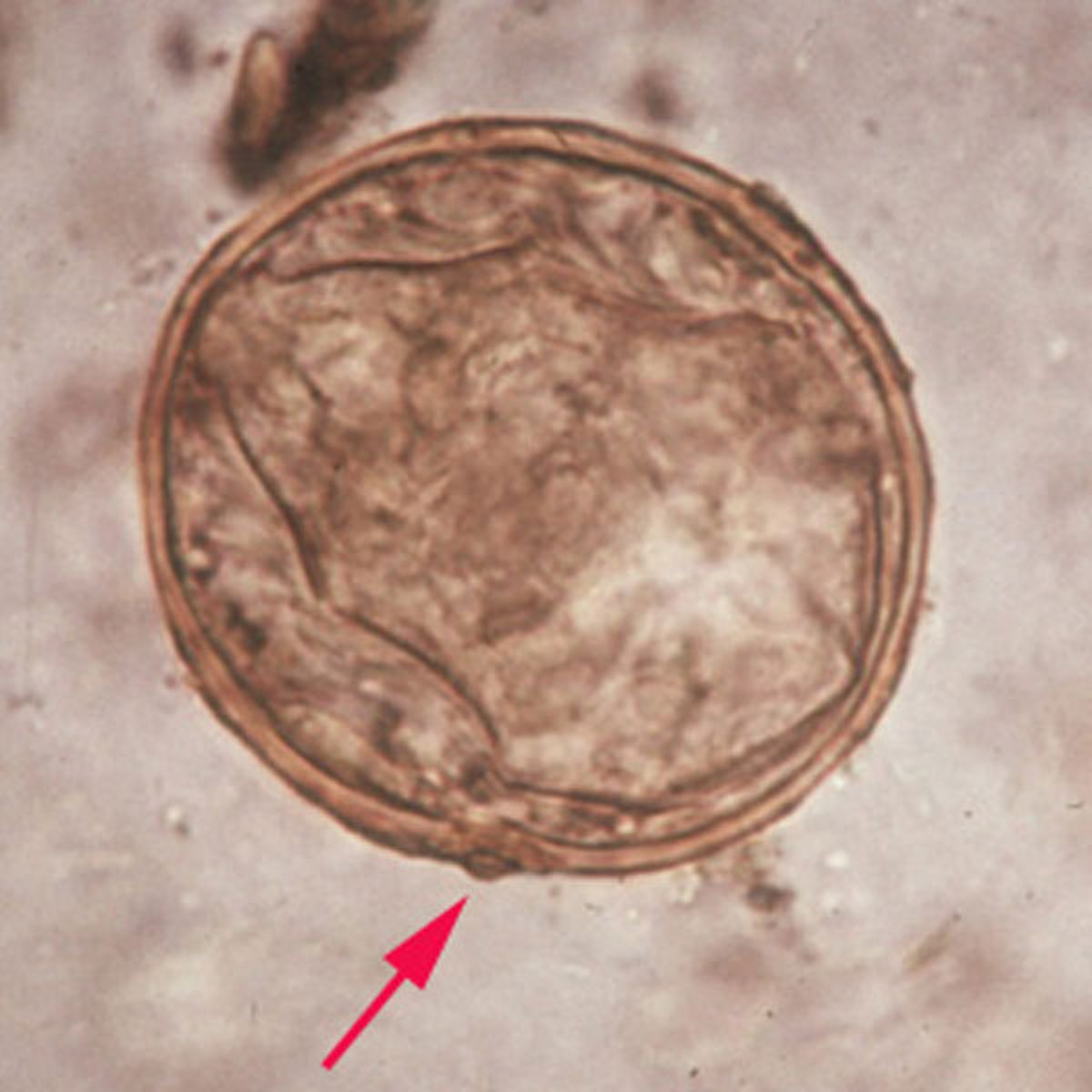 Huevo de <i >Schistosoma japonicum</i>