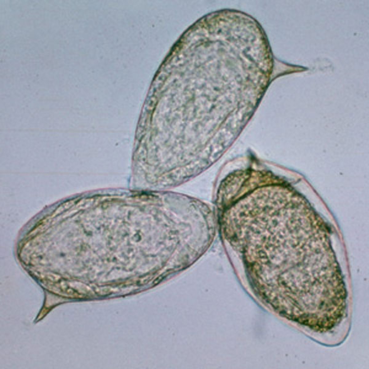Ovos de <i >Schistosoma mansoni</i>