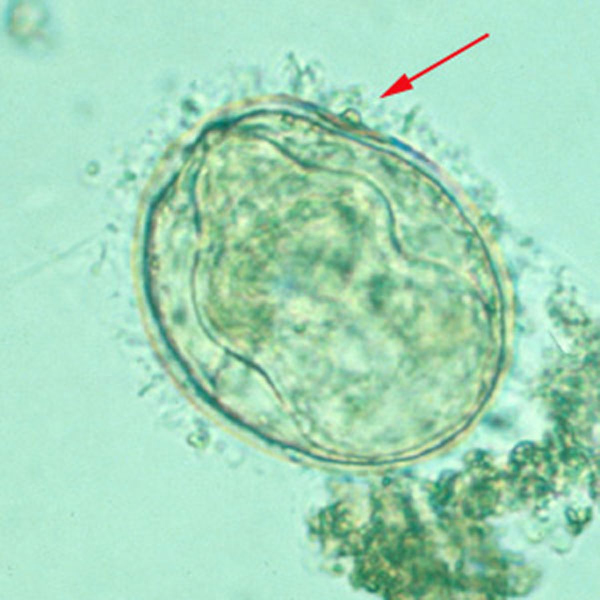 <i >Schistosoma mekongi</i> Egg