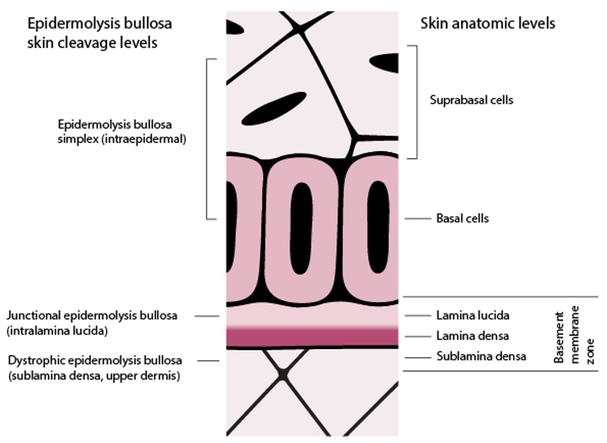 Skin Cleavage Levels in Epidermolysis Bullosa