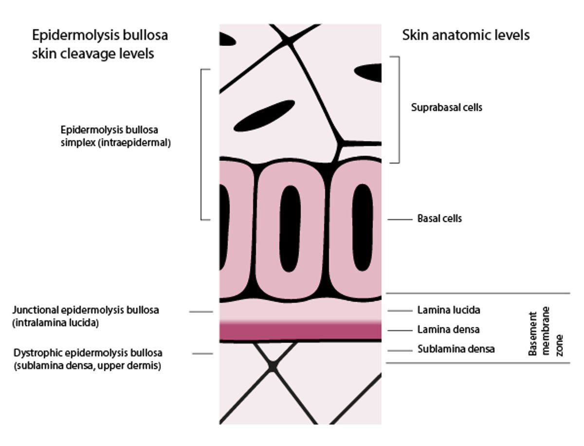 Niveles de escisión de la piel en la epidermólisis ampollosa