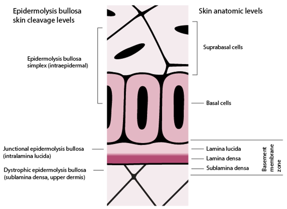 Livelli di clivaggio cutaneo nell'epidermolisi bollosa