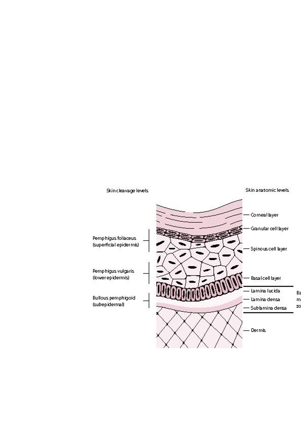 Grad der Hautschädigung bei Pemphigus und bullösem Pemphigoid