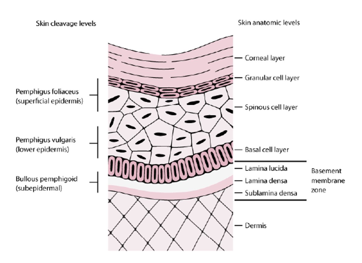 Niveles de escisión cutánea en pénfigo y penfigoide ampolloso