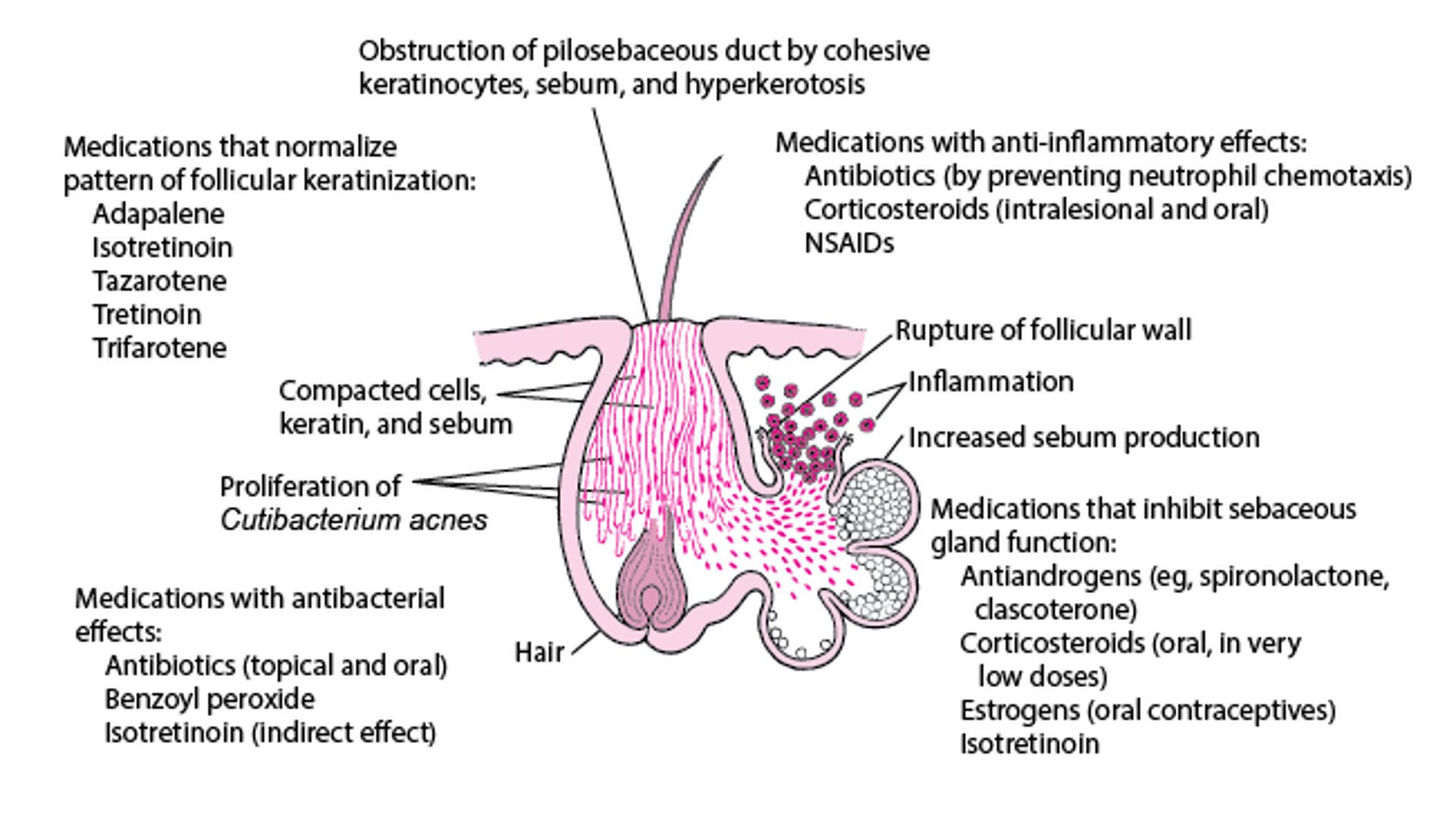 How Various Medications Work in Treating Acne