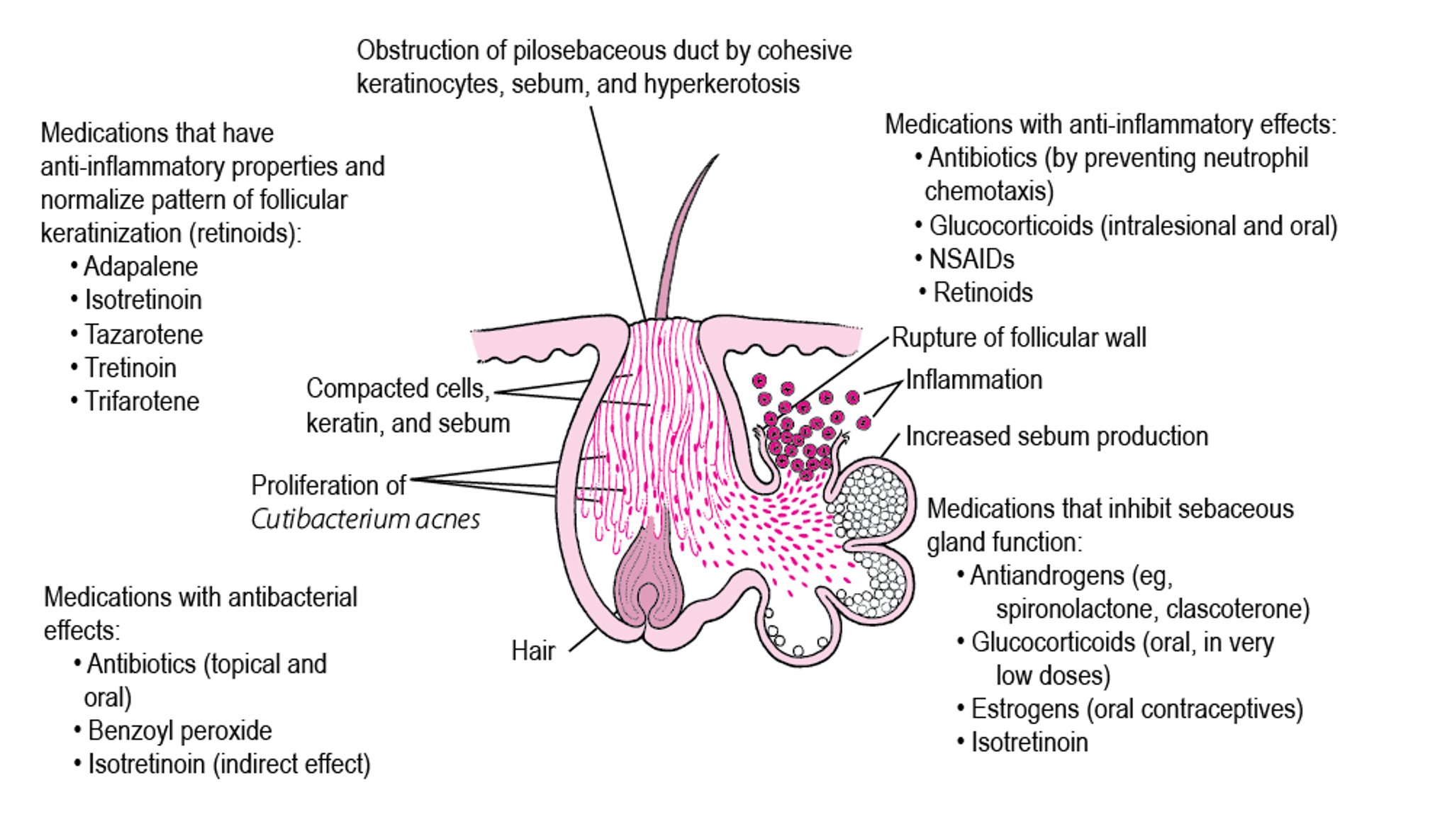How Various Medications Work in Treating Acne