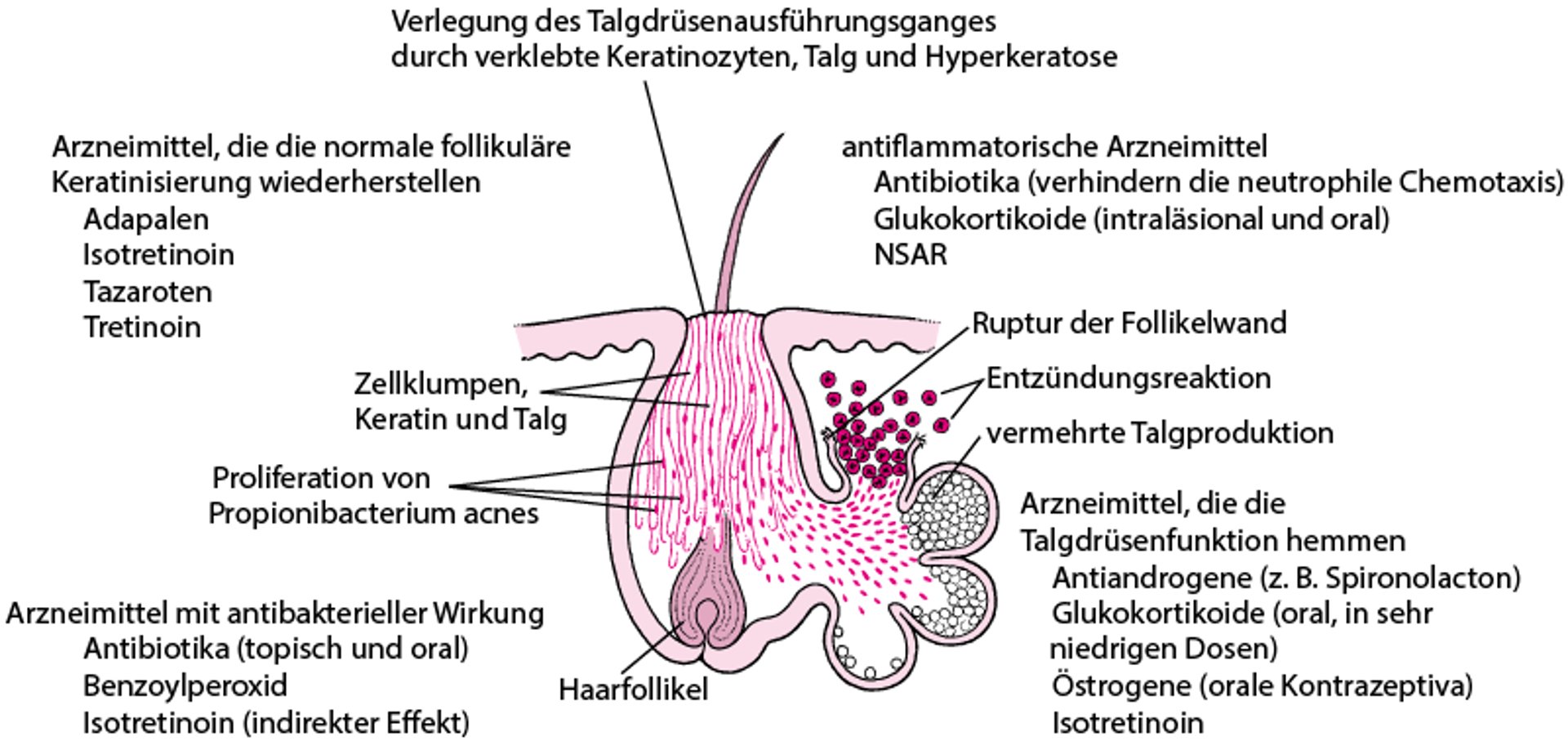 Wirkungsweise verschiedener Medikamente bei der Behandlung von Akne