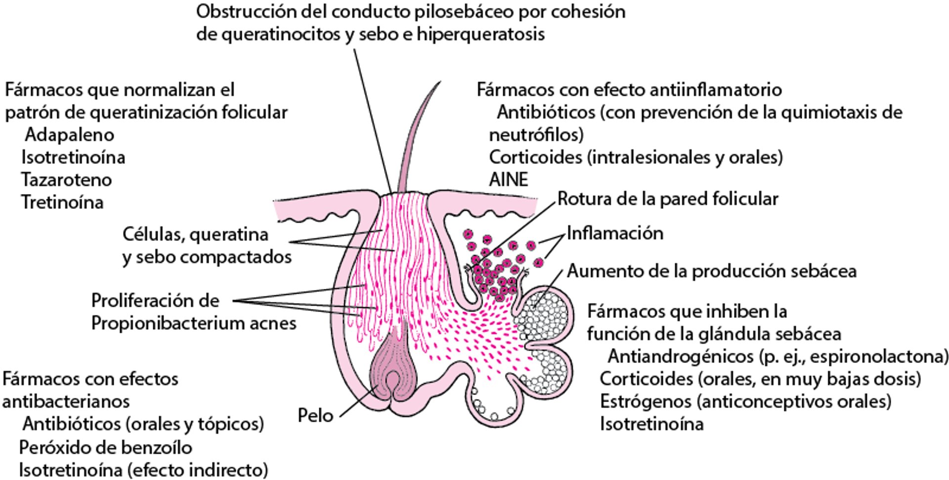 Cómo funcionan diversos medicamentos en el tratamiento del acné