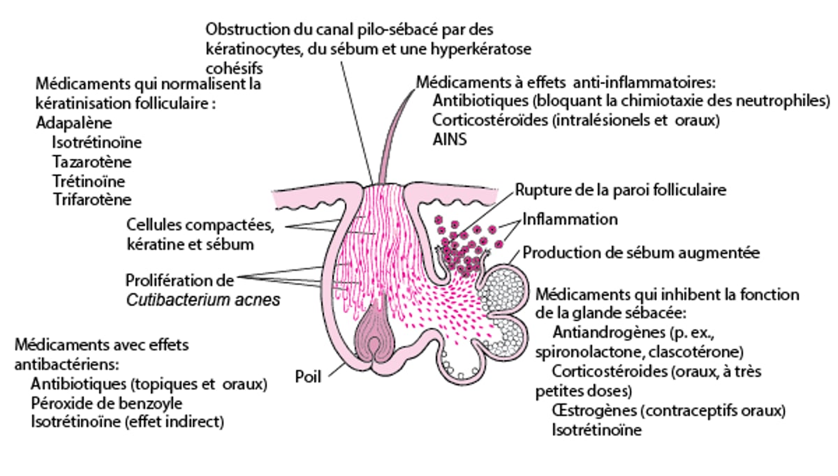 Mode d'action des divers médicaments utilisés dans le traitement de l'acné