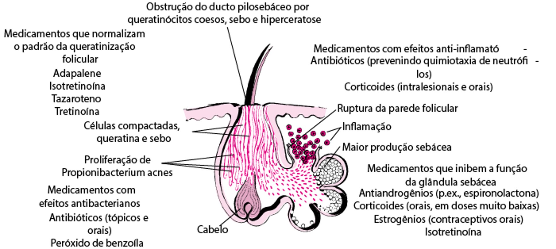 Como vários medicamentos funcionam no tratamento da acne