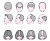 Alopecia di tipo maschile e femminile (alopecia androgenica)