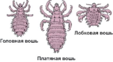 Вши крупным планом