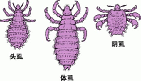 近距离观察虱子