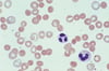 Spherocytes