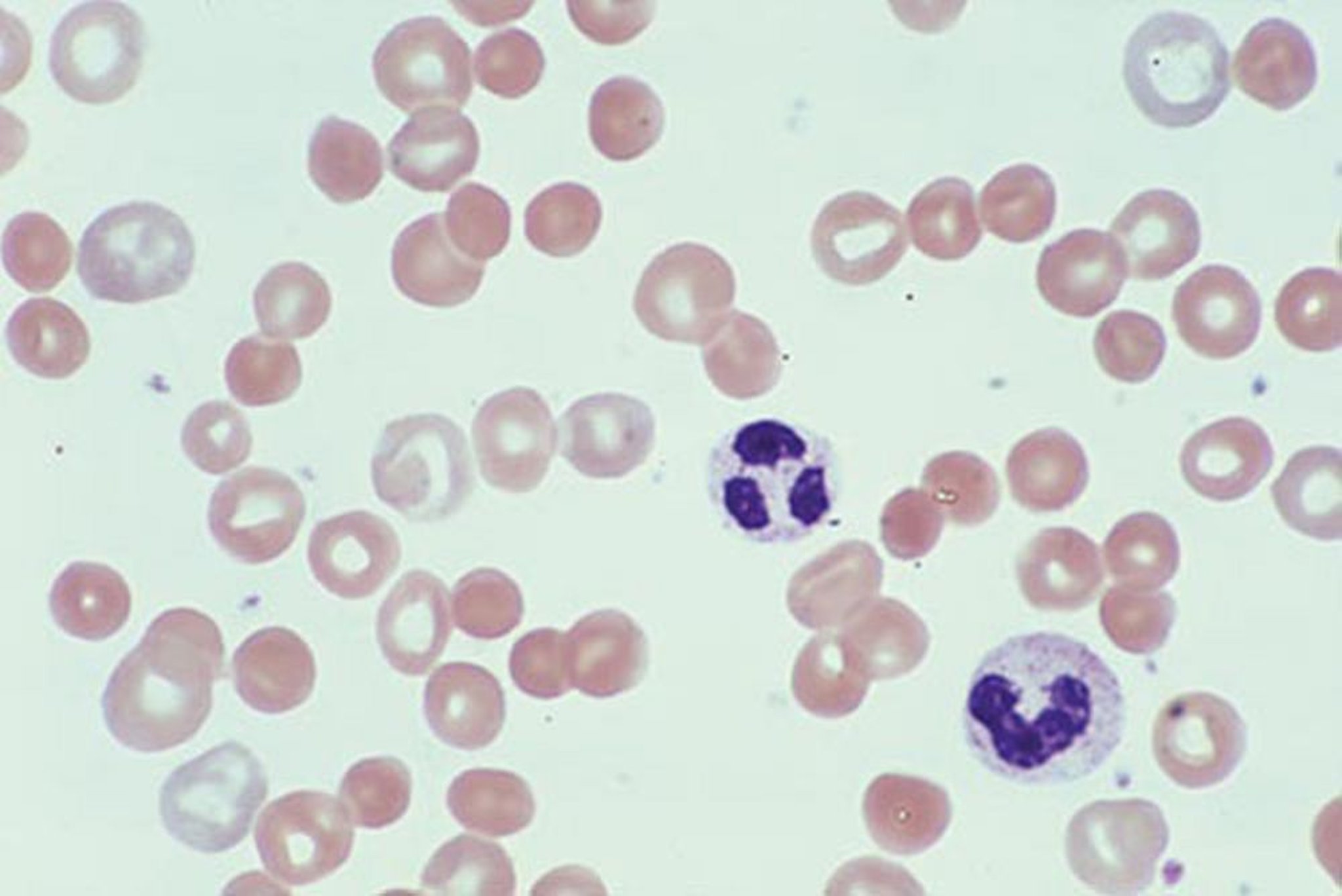 Sphérocytes