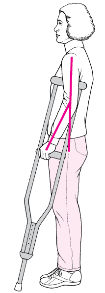 How To Fit and Walk With Underarm Crutches - Injuries; Poisoning