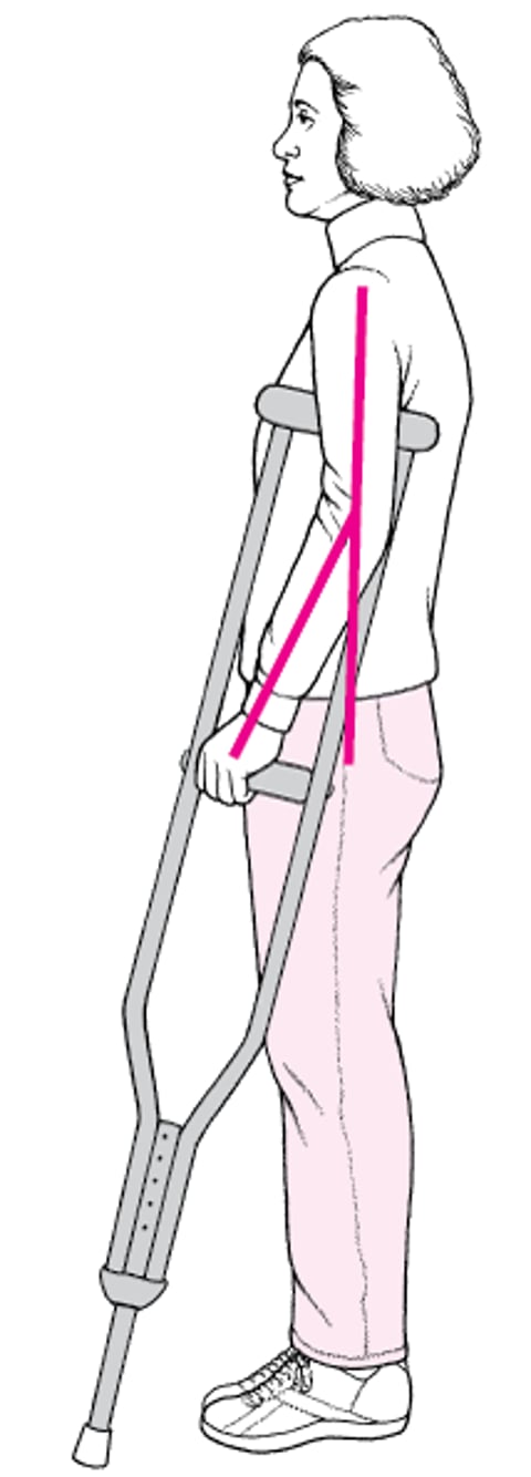 Fitting Underarm Crutches