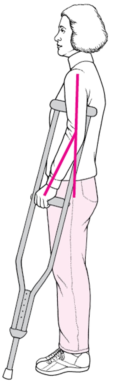 Adaptation des béquilles sous les bras