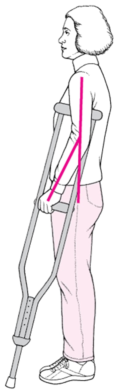 腋下拐杖安装