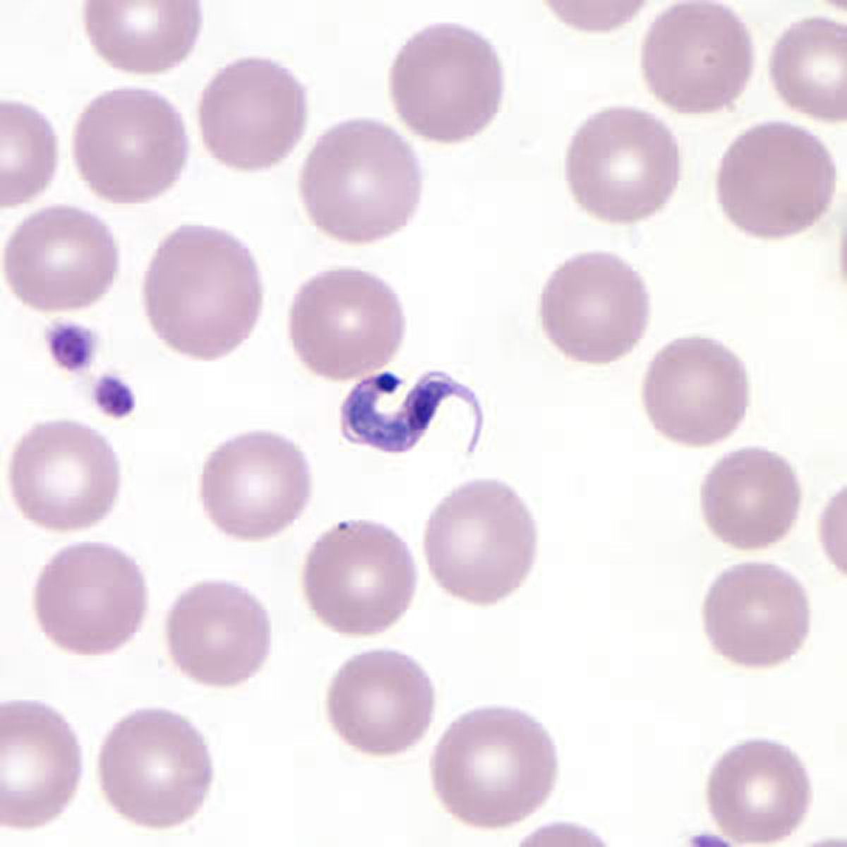 Tripomastigota de <i >Trypanosoma cruzi</i> (esfregaço sanguíneo fino)