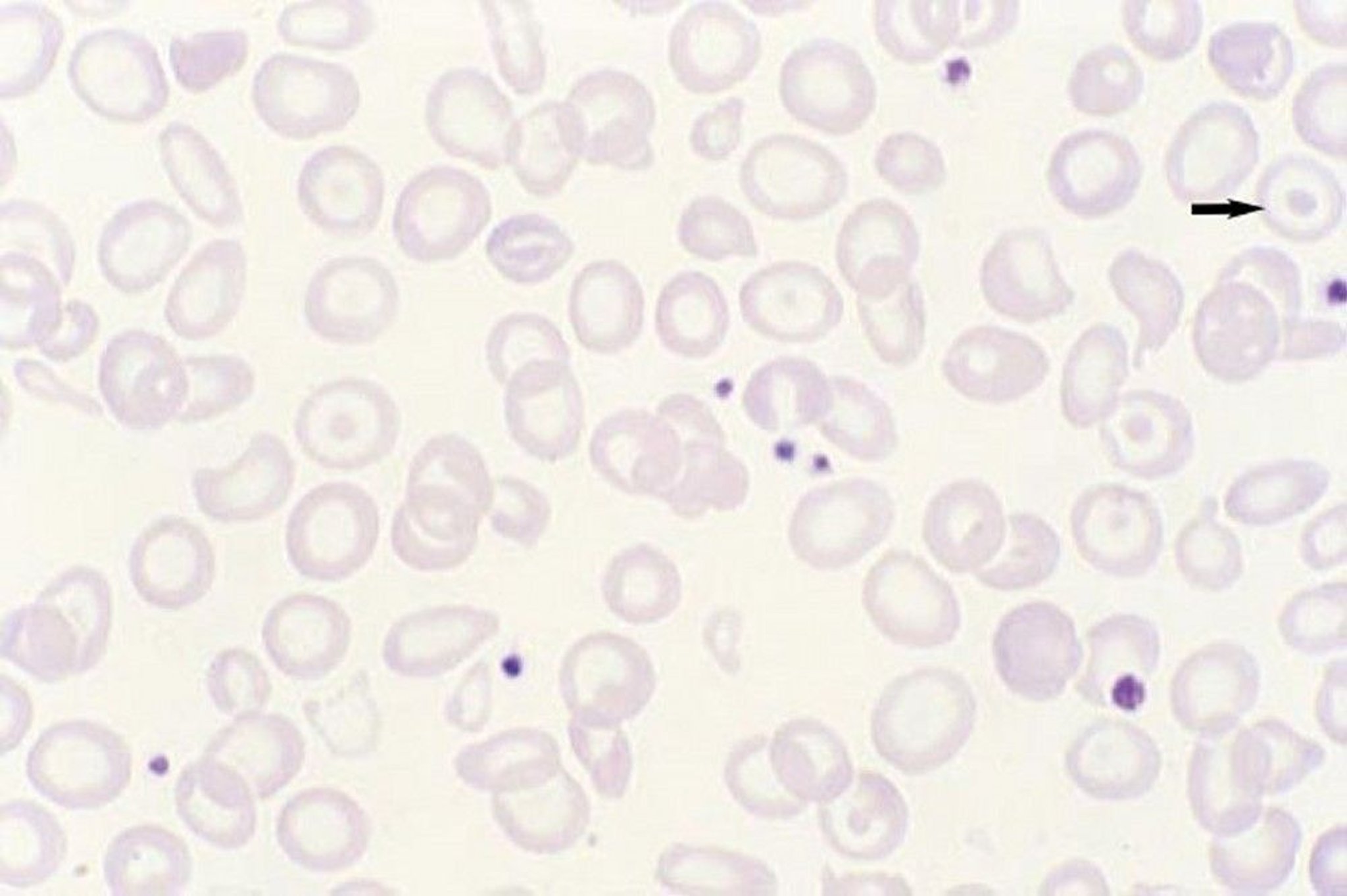 Target Cells