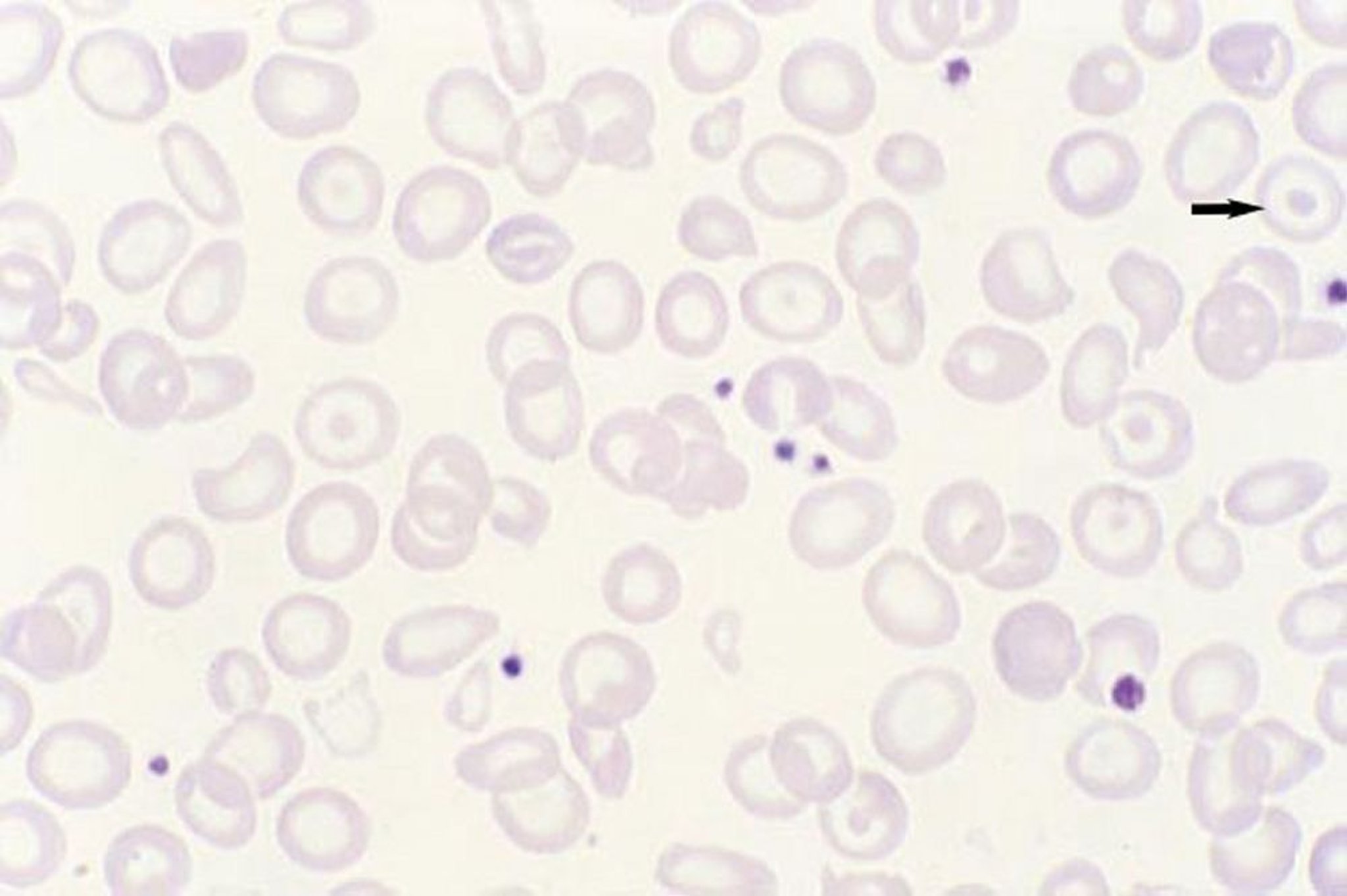 Dianocitos