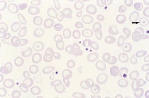 Cellules cibles
