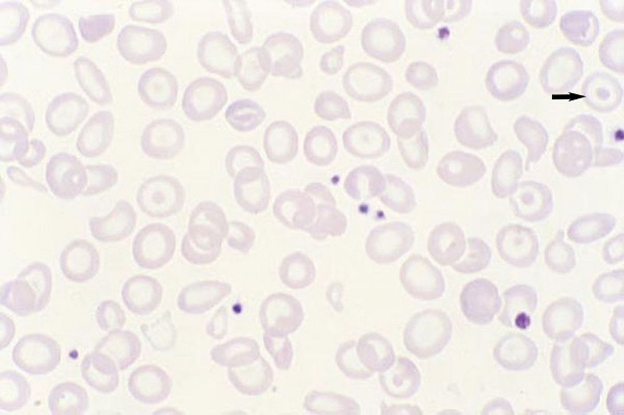 Мишеневидные клетки
