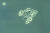 Trichomonads on Wet Mount