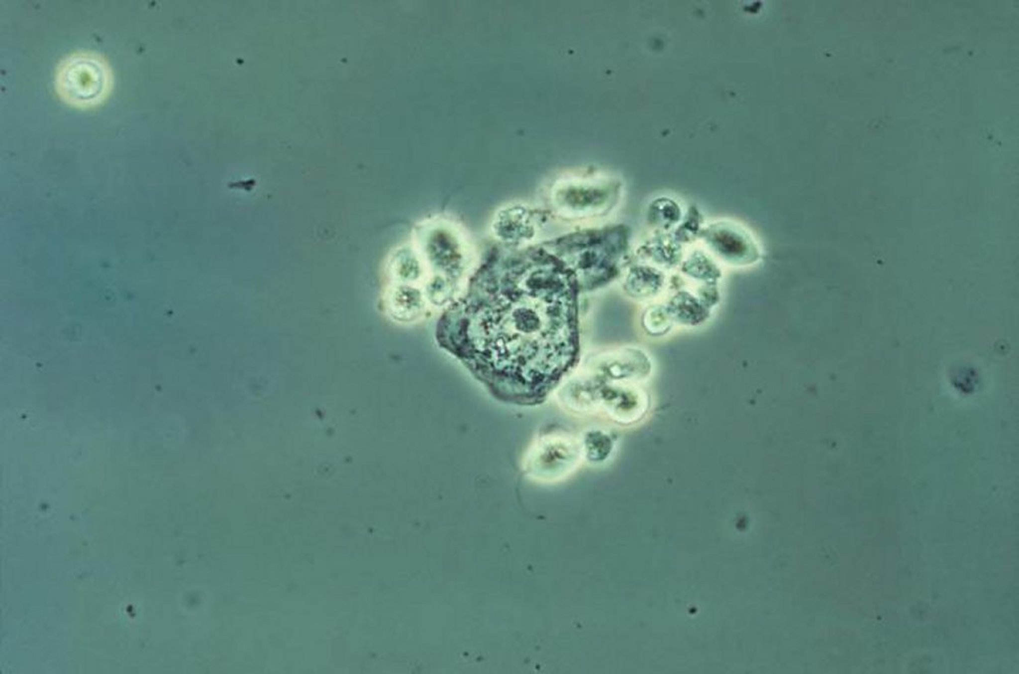 湿涂片上的毛滴虫