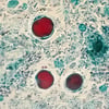 Tinción tricrómica (Blastocystis spp)