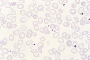 Target Cells