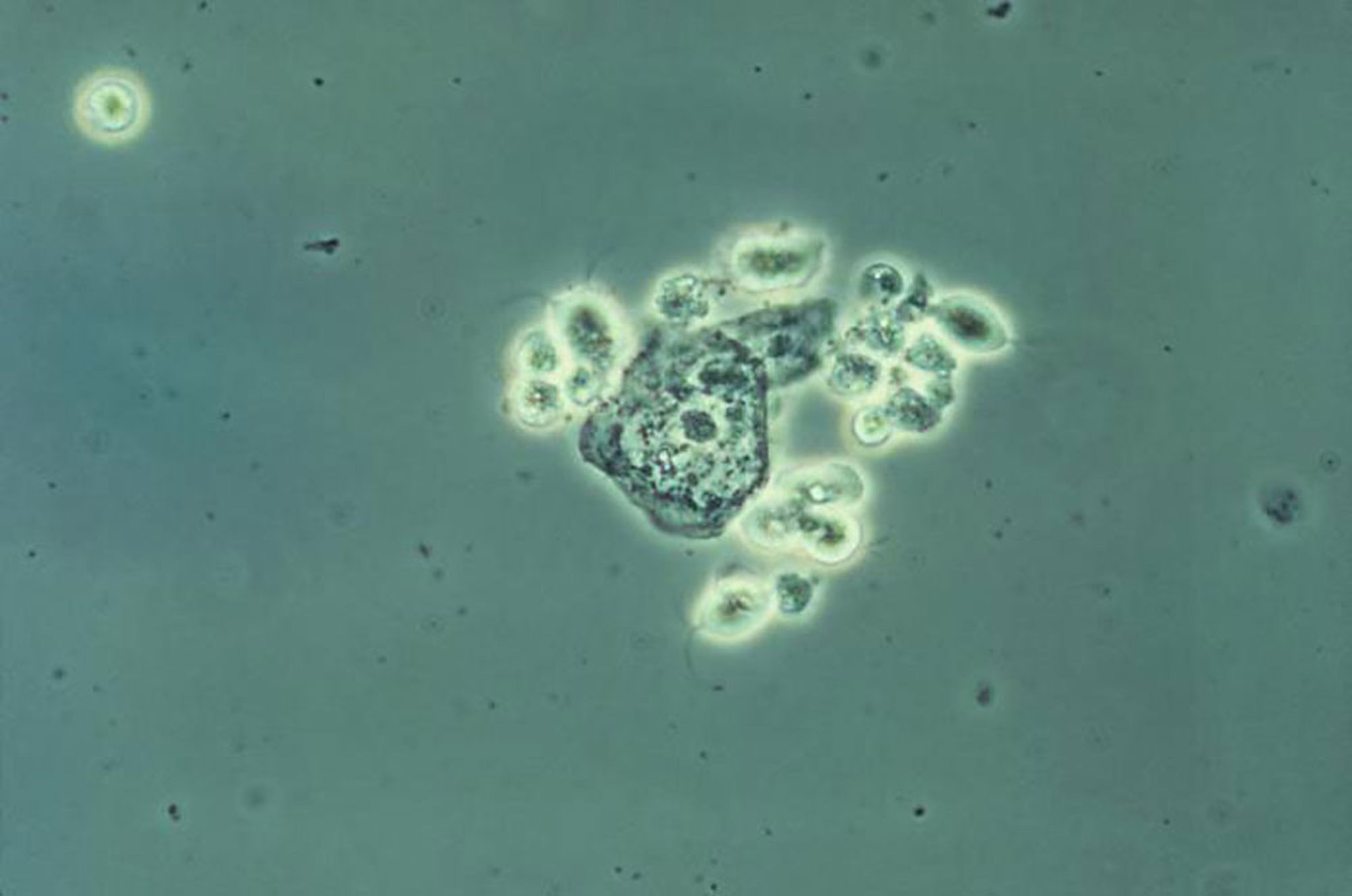 Trichomonads on Wet Mount
