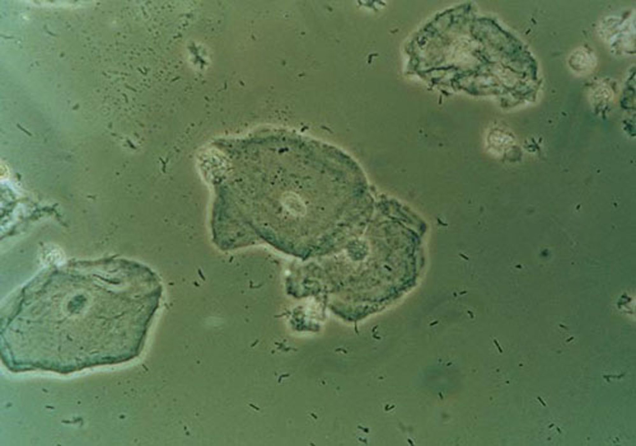 Preparado húmedo (normal)