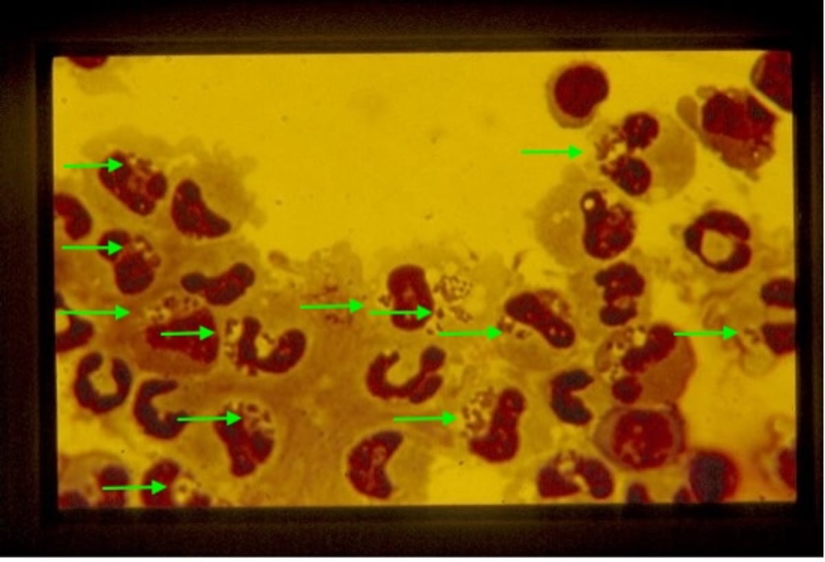 <i >Anaplasma phagocytophilum</i>, intracytoplasmic inclusions, sheep